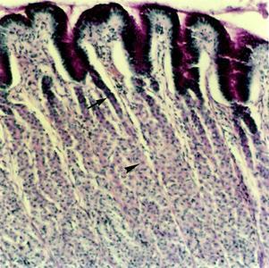 O muco secretado é visto sobre a superfície epitelial. As células oxínticas ( ) também estão coradas por causa da síntese do fator intrínseco. PAS/H. Objetiva de 10x (137x). MMC MML Figura 8.
