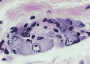 Na submucosa do duodeno, há as glândulas duodenais (ou de Brünner), que são glândulas tubulares ramificadas mucosas.
