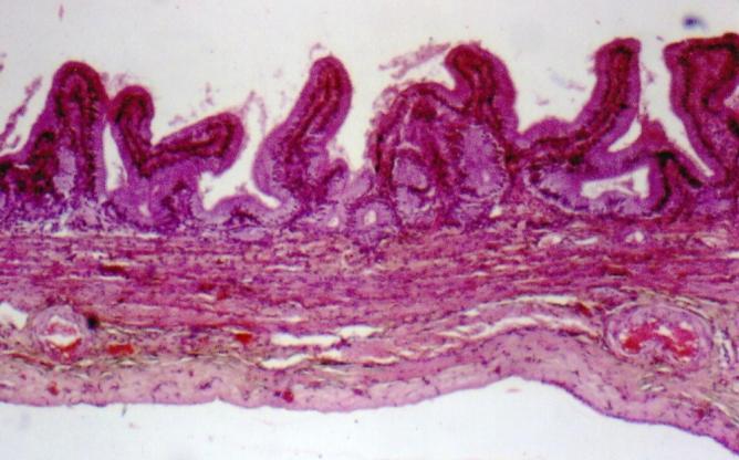 TATIANA MONTANARI 2.4.3 Vesícula biliar É um órgão oco, piriforme, com 3 a 5cm de diâmetro e 10cm de comprimento e capacidade para 50mL, situado na superfície inferior do fígado.