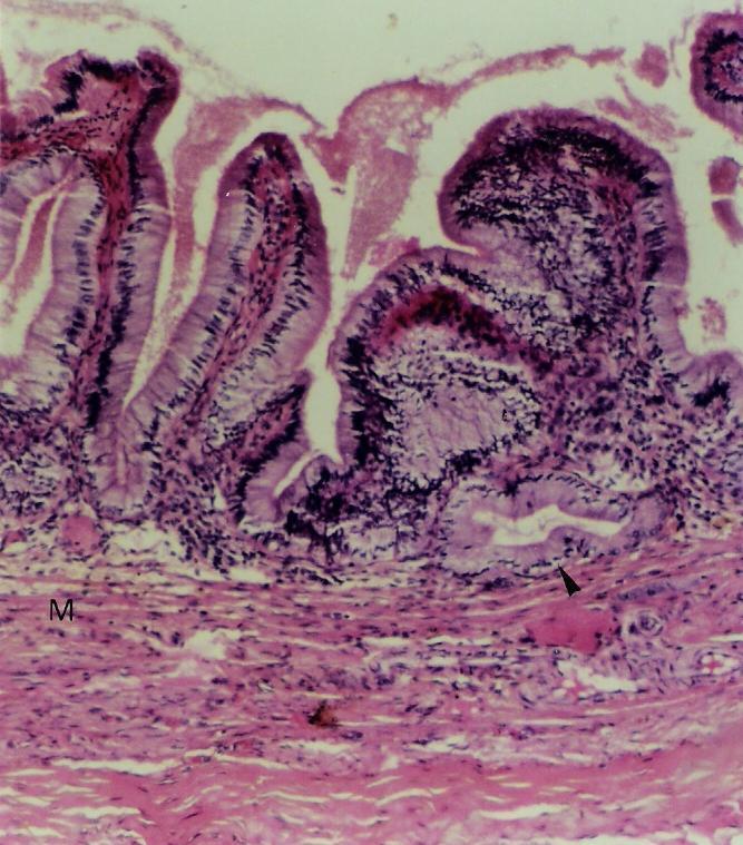285 A bile produzida no fígado é armazenada e concentrada na vesícula biliar. A mucosa forma pregas quando o órgão está vazio. O epitélio é simples colunar com microvilos (Figuras 8.32 a 8.34).