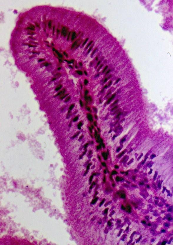 HISTOLOGIA Figura 8.34 - Prega da mucosa da vesícula biliar, mostrando o epitélio simples colunar com microvilos. HE. Objetiva de 10x. 3) O que são as papilas linguais?