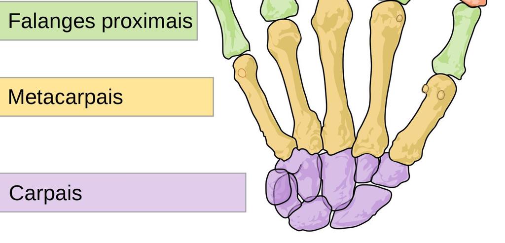 perda de segmentos de dois quirodáctilos (dois dedos), desde que atingida a falange proximal em pelo menos um deles; perda de segmento de três ou mais falanges de três ou mais quirodáctilos.