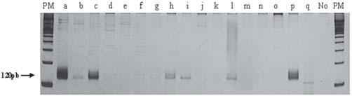 000 formas promastigotas de Leishmania chagasi; (C-) DNA de cão negativo e (No) sem DNA. PM = marcador em escada de 100pb (Invitrogen ). Figura 2.