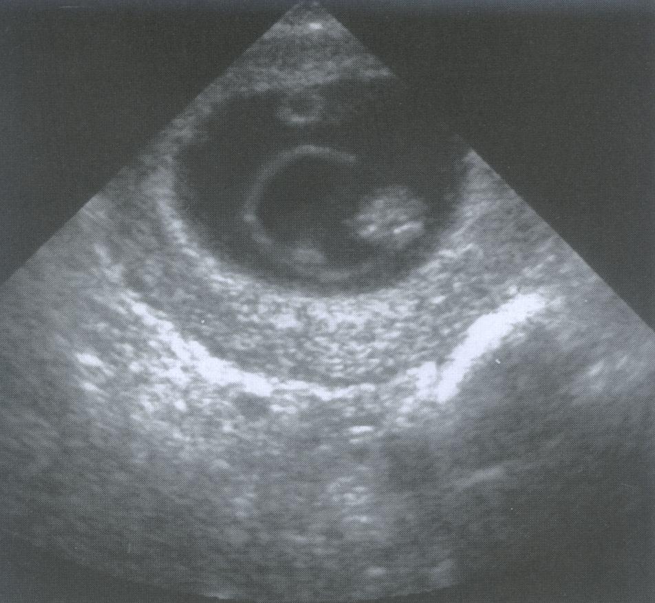 Embrião com 7 semanas.