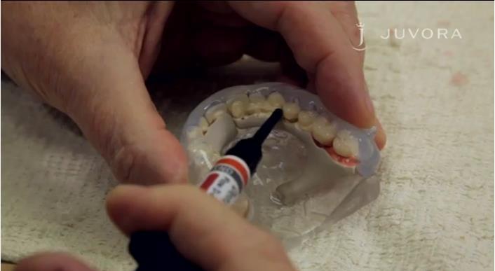 Aplicação do Fluxo de Dentina nos Dentes Pré-Fabricados 1) O fluxo de dentina deve ser aplicado ao modelo (estrutura e dentes em silicone), inicialmente a partir do lado oclusal.