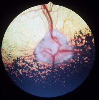 completo possível o Bons conhecimentos de anatomia ocular e crânio o Evitar fazer pressão sobre o globo e àrea periorbitária o O trauma periocular pode causar alterações