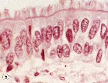 ciliado com células caliciformes