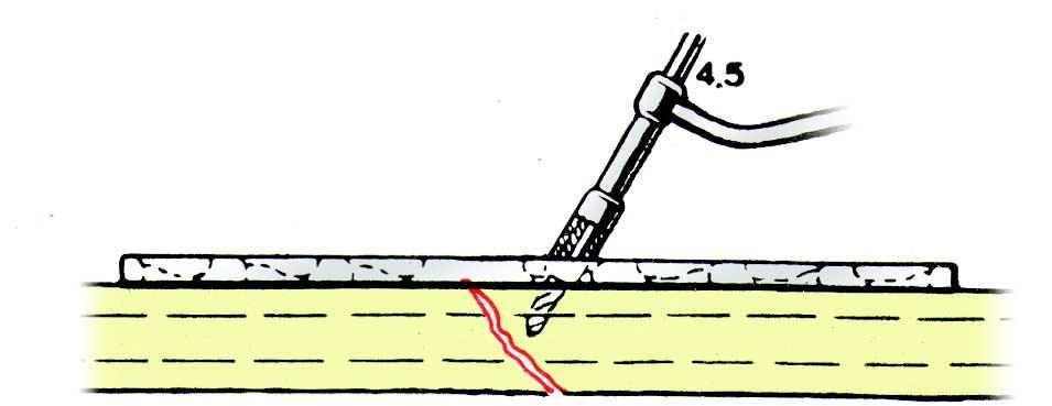 O tipo de placa (placa de 4,5 mm larga ou de 4,5 mm estreita ou a placa de 3,5 mm) e o número de parafusos dependerão do osso que está sendo fixado e da qualidade do osso.