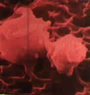ELEMENTOS FIGURADOS (Fragmentos dos Megacariócitos) 3- Plaquetas ou trombócitos: são minúsculos discos redondos ou ovais, de cerca de 2 nm de diâmetro que participam do processo de coagulação
