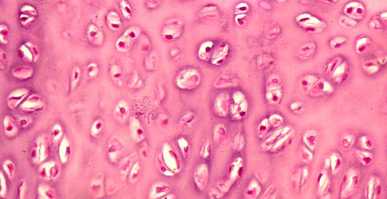 Na parte superior existe o pericôndrio fibroso e o celular (Condrogênico). Traquéia.Coloração:Hematoxilina - Eosina. Objetiva: 40x. Fig.29: TECIDO CARTILAGINOSO ELÁSTICO ELÁSTICO.