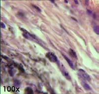 HEMATOPOIÉTICO - LINFÓIDE b) Macrófagos: células grandes de contornos irregulares, muito ativas, se locomovendo por meio de pseudópodes, com grande capacidade fagocitária.