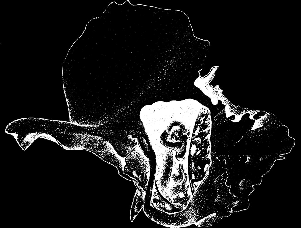 Canais semicirculares: Superior Lateral Posterior Parede do seio sigmóideo Canal facial Processo estilóide FIGURA 1.12 Cavidade mastóidea esquerda. (Adaptada de Anson; Donaldson, 1981.