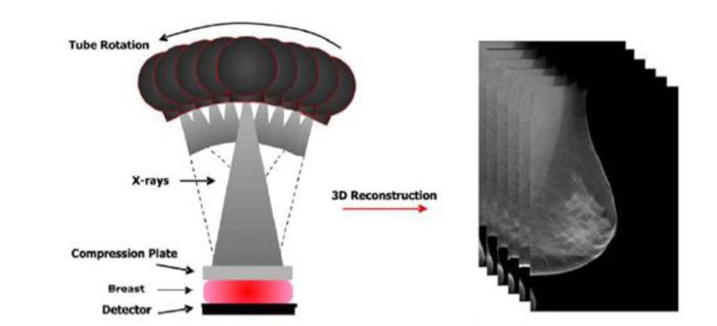 Tomossíntese Digital da Mama Normalmente, as imagens são obtidas com 11 projecções numa angulação de -25 a 25. Kontos, D.