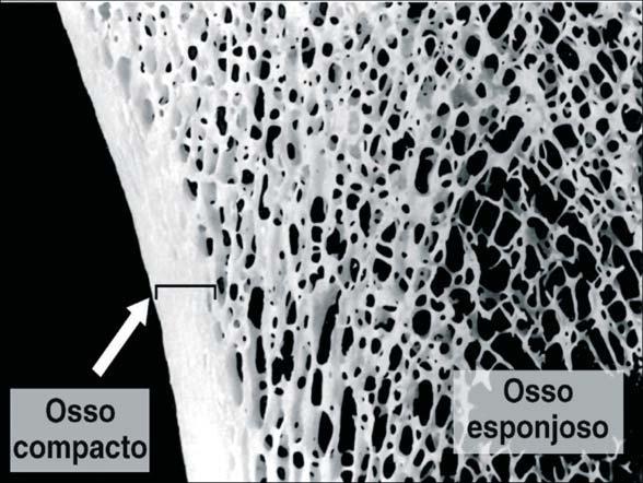 Tecido Ósseo Aula 6 Figura 6C. Corte grosso de um osso seco, mostrando o osso mais interno esponjoso e o cortical compacto. Fonte: Junqueira & Carneiro, 2008, p.139.