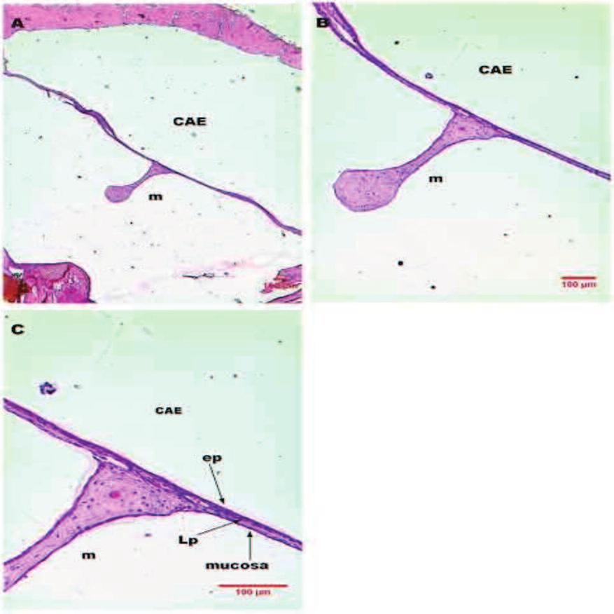 Spontaneous healing of the tympanic membrane 337 Figura 7 Imagens de corte histológico de MT de rato após 14 dias de perfuração traumática corado em HE.