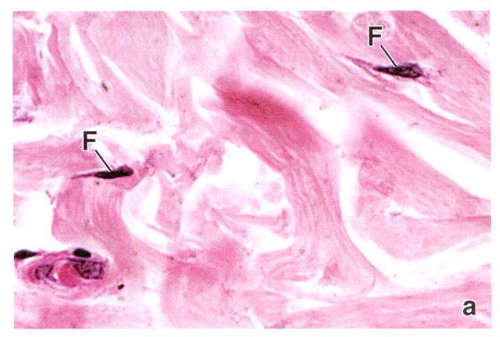 Fibroblasto