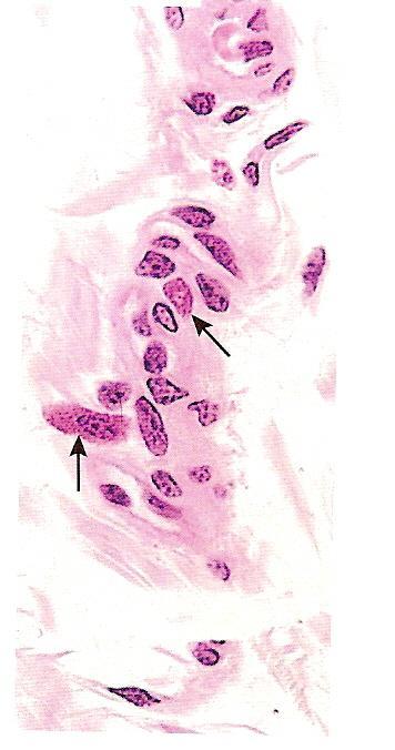 Mastócito conjuntivo HE Mastócito Fibroblastos 1.