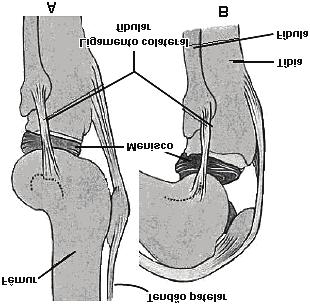 Fixação F 4) (CPS) 5 d r o a b Visão lateral da articulação do joelho: (A) não flexionado e (B) flexionado c d Hoje em dia não se pode falar em medicina esportiva sem falar em ressonância magnética,