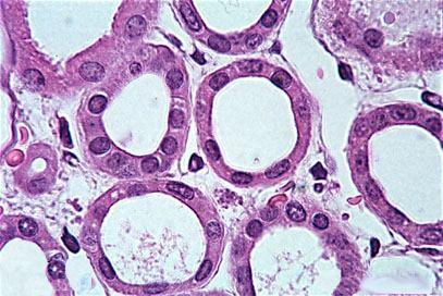 Túbulo distal -Células cúbicas; - Poucas microvilosidades; -