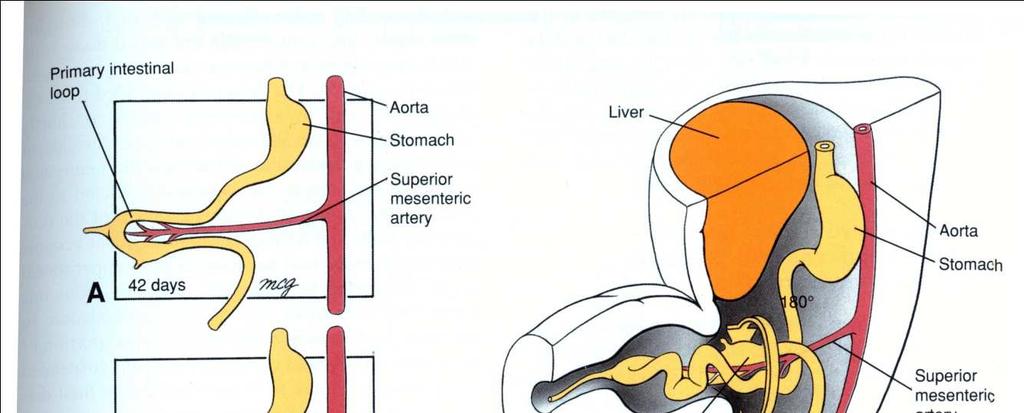 herniação intestinal ao nascer.