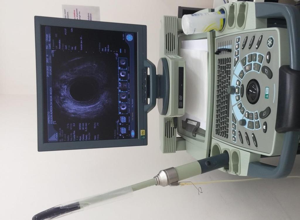 26 Figura 2. Aparelho de ultrassonografia com estação de trabalho e transdutor acoplados, onde foram geradas todas as imagens do estudo.
