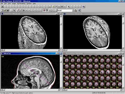 Processamento de Imagens Envolve técnicas de transformação de imagens visando melhorar a qualidade da imagem (foco, ruído, contraste) Utiliza técnicas de