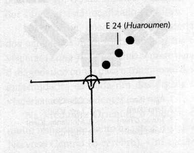 11 Fig. 1.2 Método do agulhamento das três estrelas, em sequência. INADA, T. Técnicas simples que completam a acupuntura e a moxabustão, 2003.