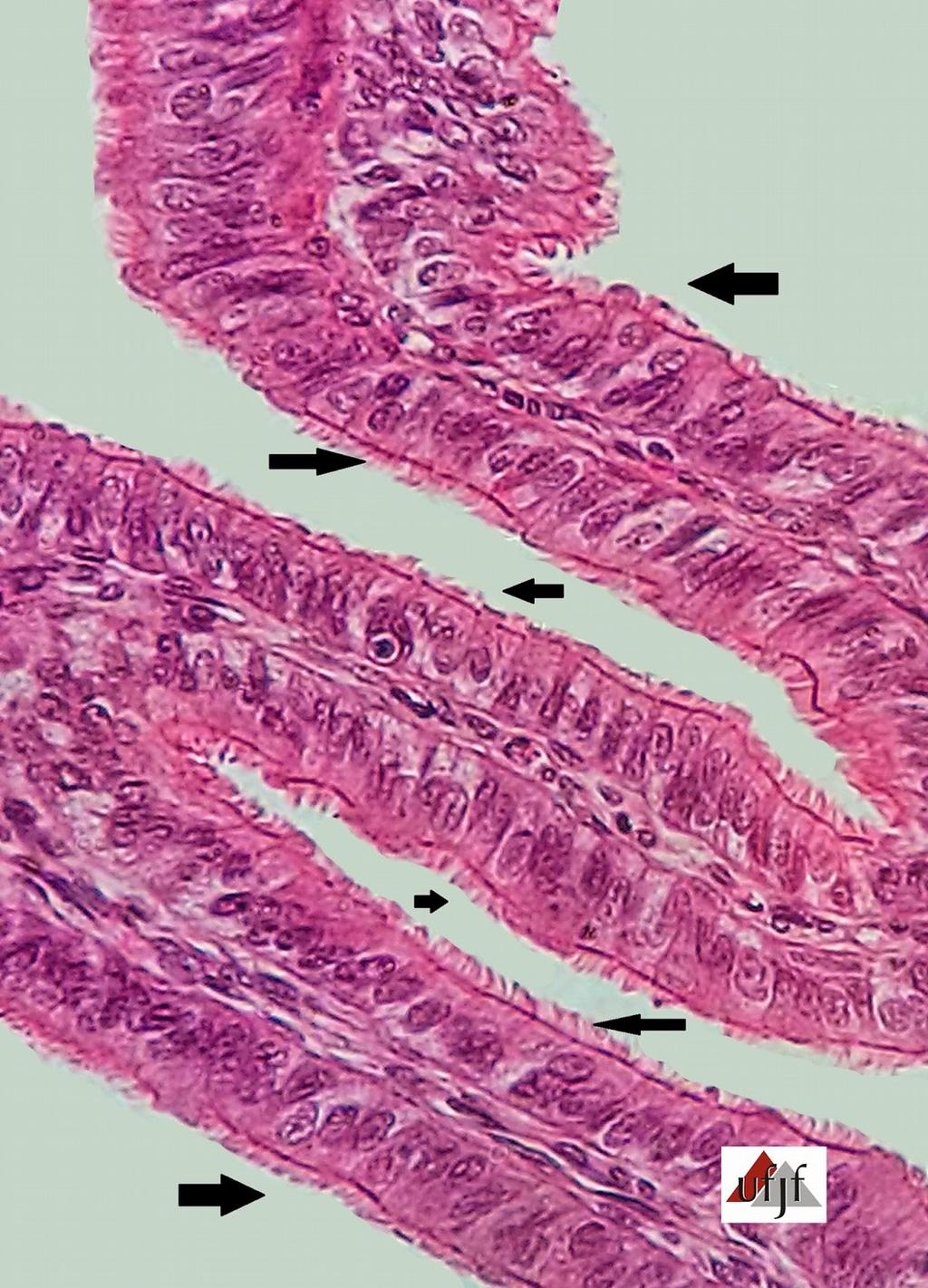 lúmen intestinal e do lúmen da