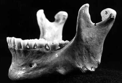 Espinha nasal anterior Figura 2-10 Vista lateral de uma mandíbula separada do crânio.