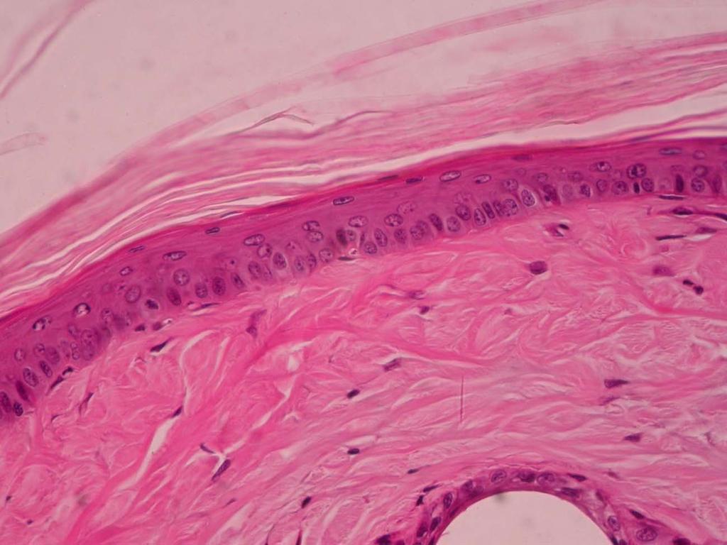 Observação com aumento total de 400x: Observe o detalhe da epiderme, com a queratina no estrato córneo, uma camada de células pavimentosas no estrato granuloso, duas ou três