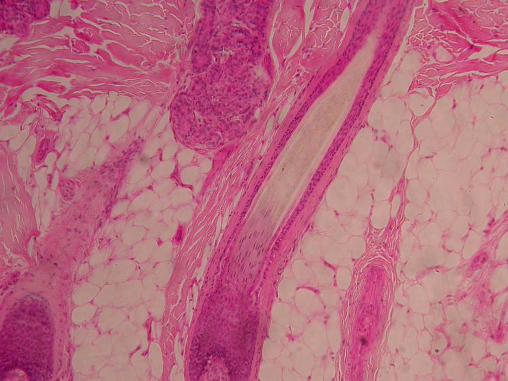 Observação com aumento total de 100x: Neste aumento e nesse campo microscópico, é possível observar-se a parte inferior da derme com corte longitudinal do folículo piloso, mostrando