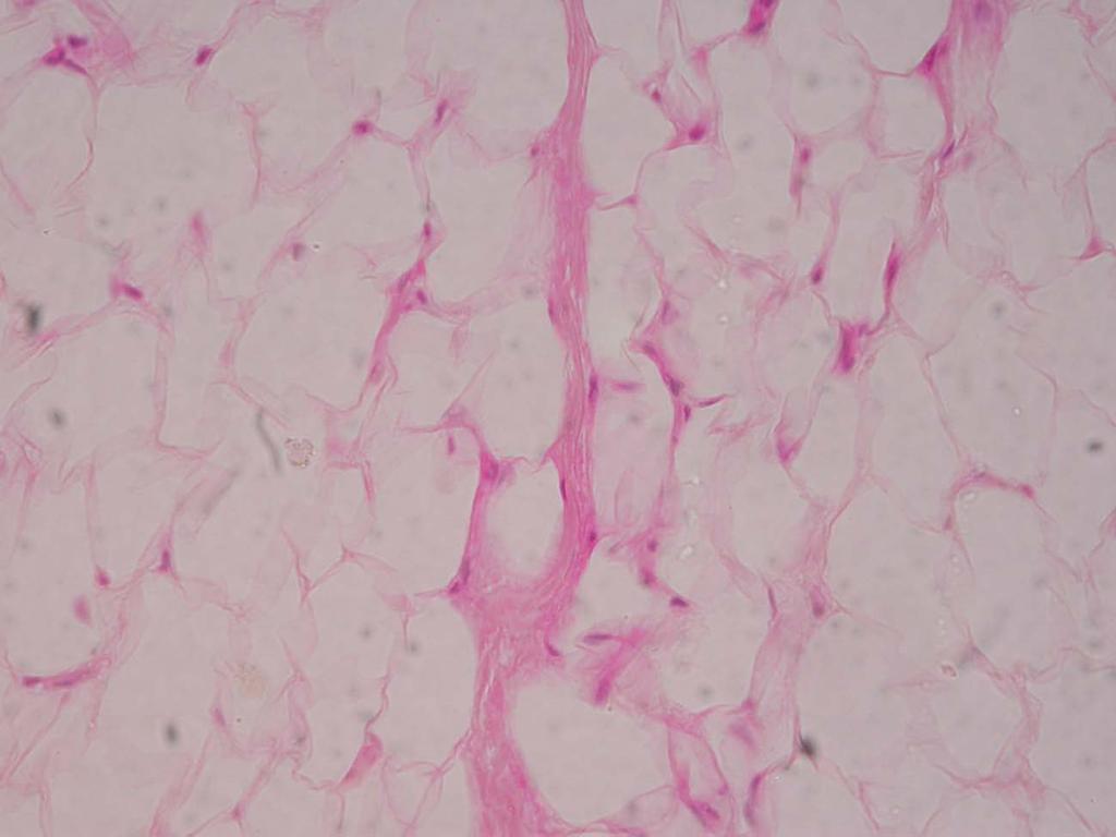 Observação com aumento total de 400x: Nesta outra parte do campo microscópico, observamos o tecido