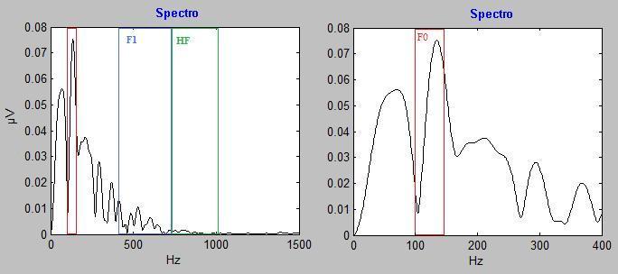 Métodos 61 Figura 4 - Resposta do Tronco Encefálico para a sílaba de fala /da/ no domínio da frequência, mostrando os elementos F0 (103-121 Hz), F 1 (455-720 Hz) e HF (721 1154 Hz).
