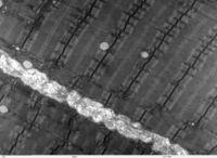 Micrografia eletrônica de uma fibra muscular estriada de coelho. As miofibrilas se estendem diagonalmente do canto superior esquerdo ao inferior direito.