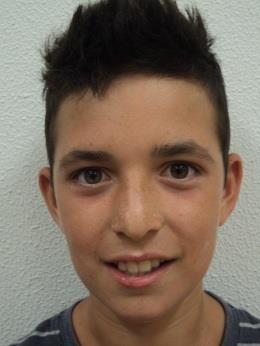 Olá sou o Guilherme e tenho 10 anos. Estou no 4.º ano na turma C. Tenho cabelo castanho e curto, orelhas pequenas e olhos verdes como a erva. O meu nariz é pequeno e arrebitado.