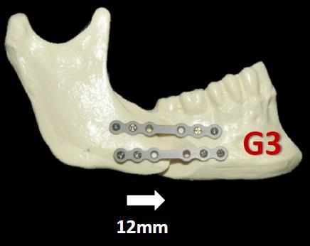 grupo G2 (teste 2).