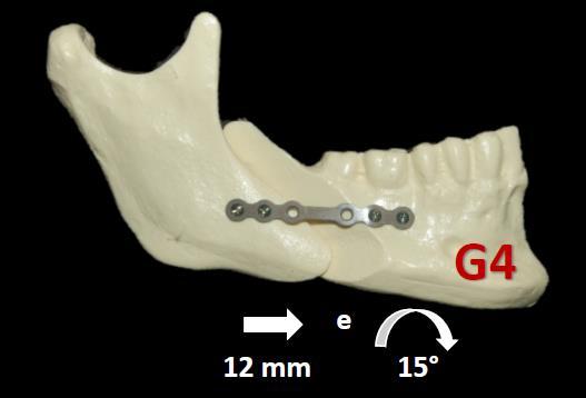 29 Figura 6: grupo G4 (teste 4). Figura 7: grupo G5 (teste 5). A fixação dos segmentos foi realizada por meio de placas e parafusos de fixação do sistema 2.