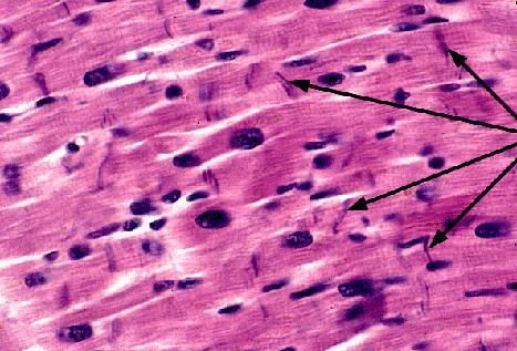 Músculo estriado cardíaco Discos