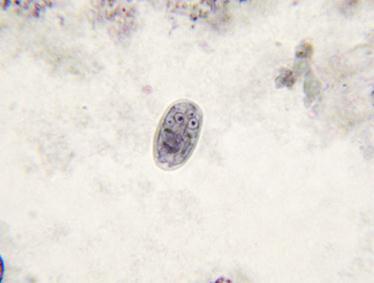 LAM Nº 14 Giardia duodenalis (forma cisto) Coloração: