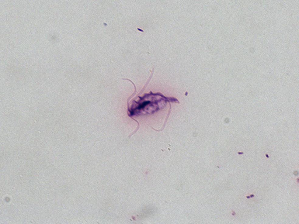 LAM Nº 16 Trichomonas vaginalis (forma trofozoíto) Coloração: