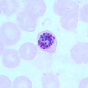 LAM Nº 20 Plasmodium falciparum (forma esquizonte) Coloração: