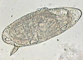 LAM Nº 41 Shistosoma mansoni (ovo) Coloração: Lugol Material de preparação: fezes Características: Forma oval ou