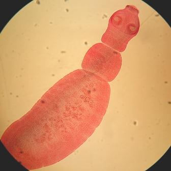 LAM Nº 47 Echinococcus granulosus (verme adulto)