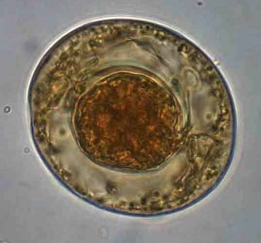 LAM Nº 53 Hymenolepis nana (ovo) Coloração: Lugol Material de preparação: Fezes Características: arredondado ou ovalado com dupla membrana (casca).