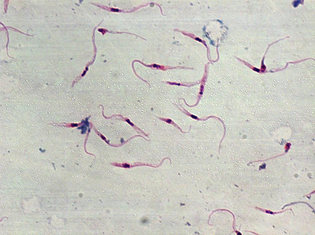 LAM Nº 2 Trypanosoma cruzi (forma epimastigota) Coloração: