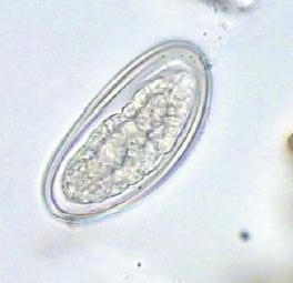 LAM Nº 63 Enterobius vermicularis (ovo) Coloração: Lugol Material de preparação: fezes Características: forma