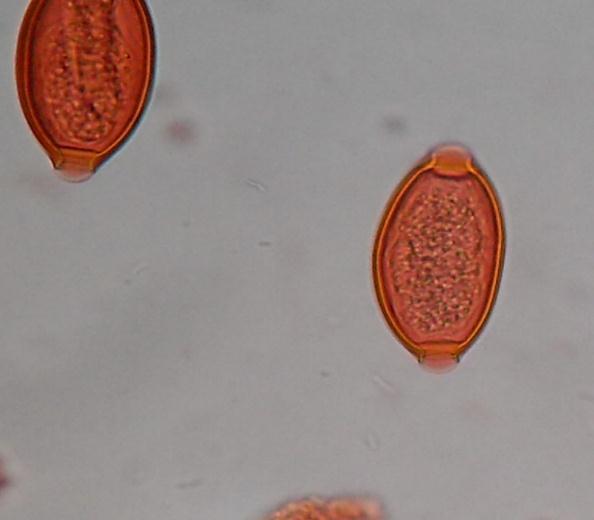 LAM Nº 64 Trichuris trichiura (ovo) Coloração: Lugol Material de preparação: fezes