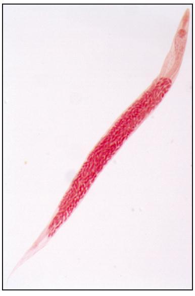 LAM Nº 67A Enterobius vermicularis (fêmea gravídica) Coloração: Carmin