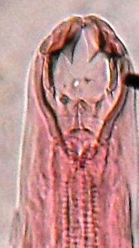 LAM Nº 71 Ancylostoma braziliense (verme adulto) Sem coloração Material