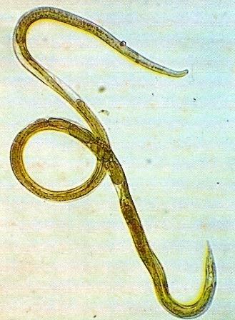 LAM Nº 74: Strongyloides stercoralis (fêmea partenogenética) Coloração: Lugol